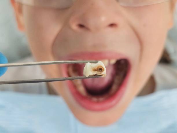 Best After-Hours Emergency Dentist in Centerville, GA